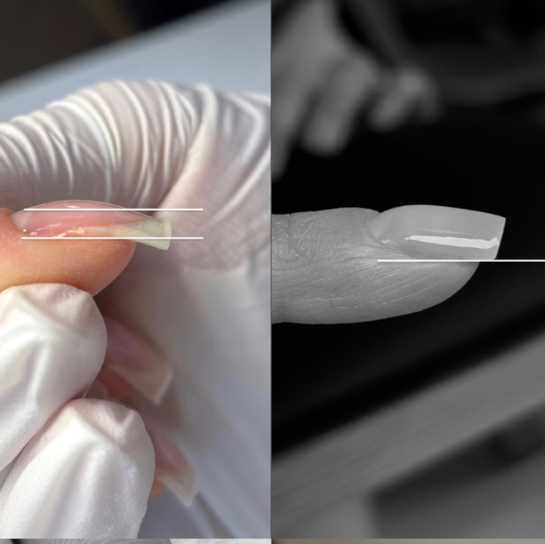 Сложная коррекция