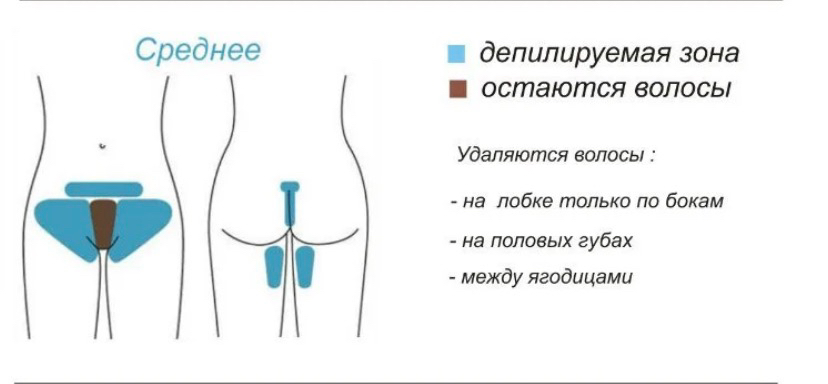 Депиляция шугаринг бикини-среднее