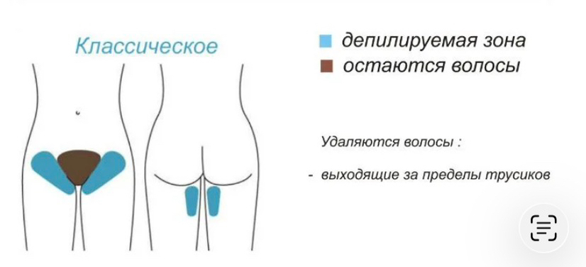 Депиляция шугаринг - бикини классическое
