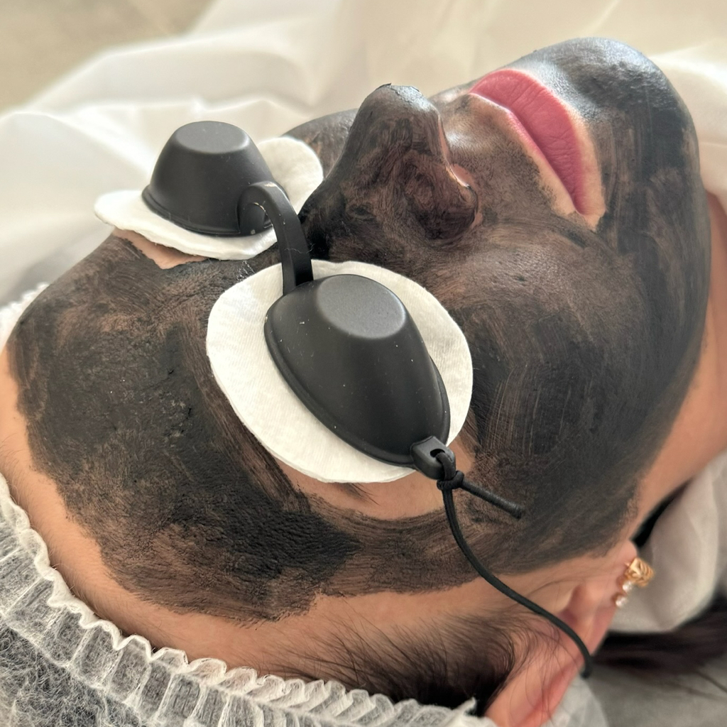 Карбоновый пилинг