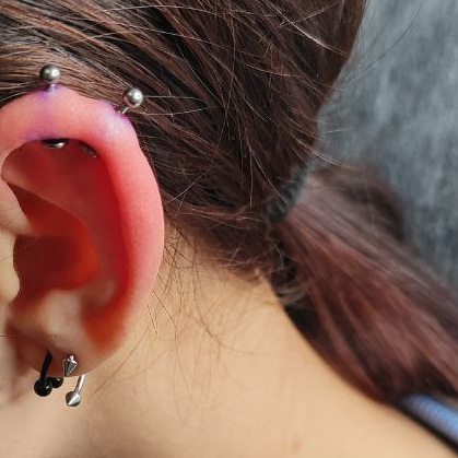 127 Прокол двух хрящей