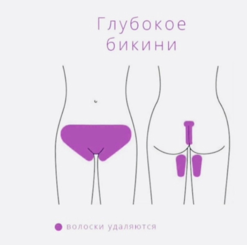 Депиляция Бикини глубокое