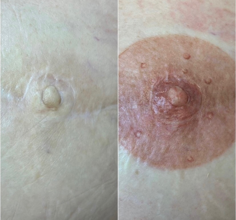 Перманентный макияж Восстановление ореол