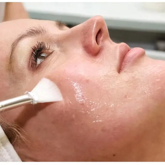 Пилинг Джесснера