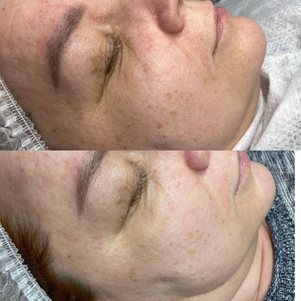 FlaxNewSkin — липосомальная система для обновления кожи