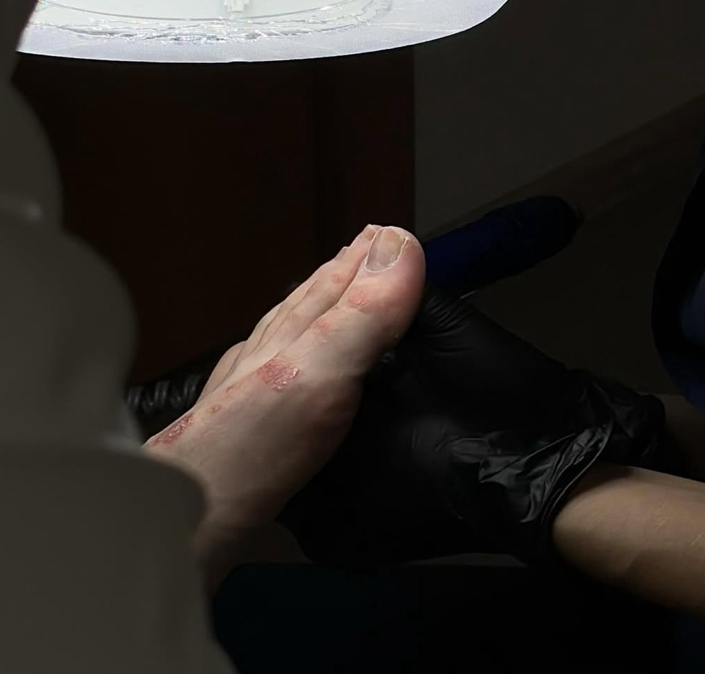 Мужской педикюр