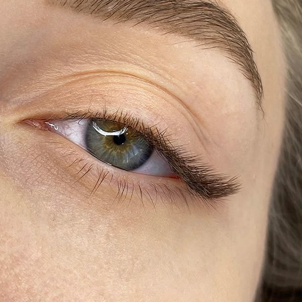 наращивание уголков