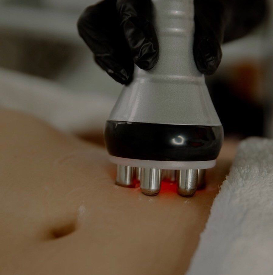 RF-лифтинг тела 10 сеансов