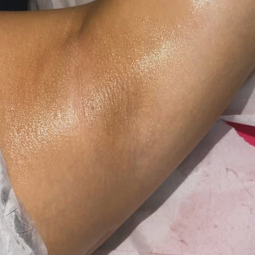 Депиляция подмышечной впадины ( полимерный воск )