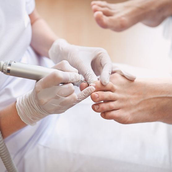 Педикюр медицинский Smart