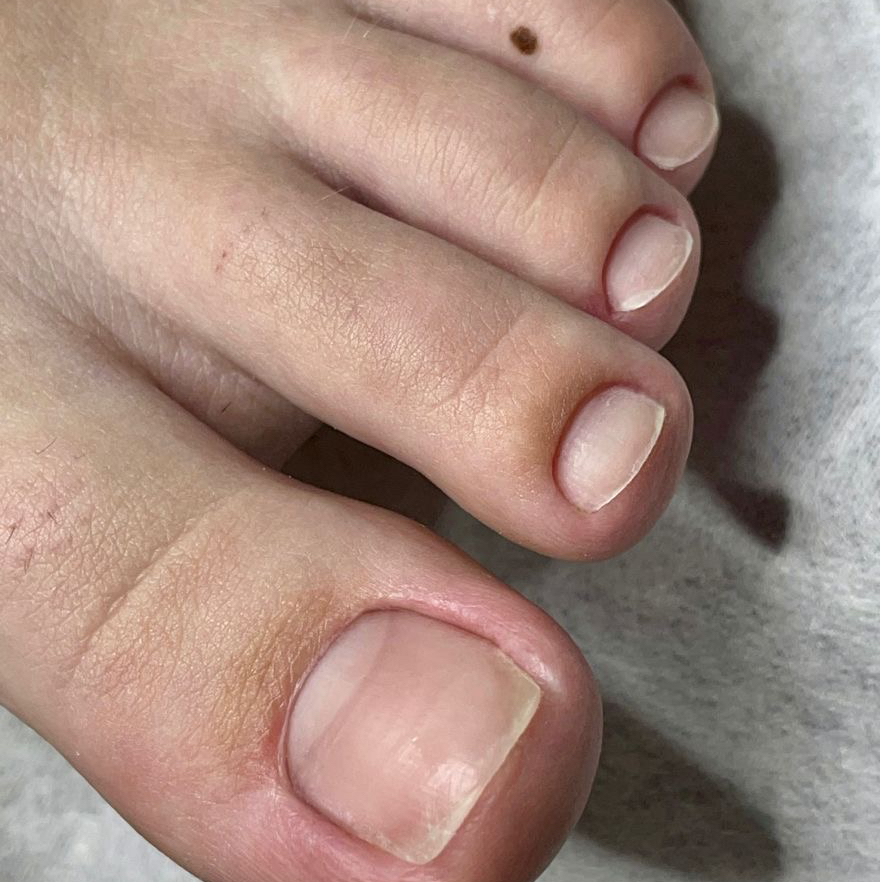 Педикюр мужской