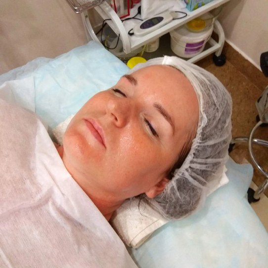 Гликолевый пилинг с ДМАЭ  и пептидами