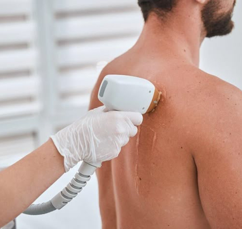 Спина полностью  (мужская эпиляция)