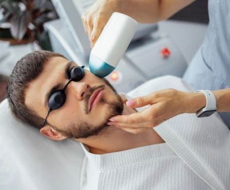 Лицо полностью  (мужская эпиляция)