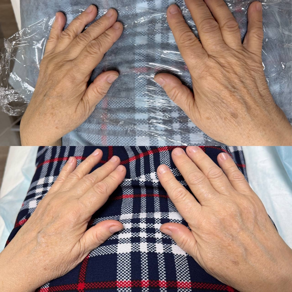 Spa - комплекс (рук,ног)