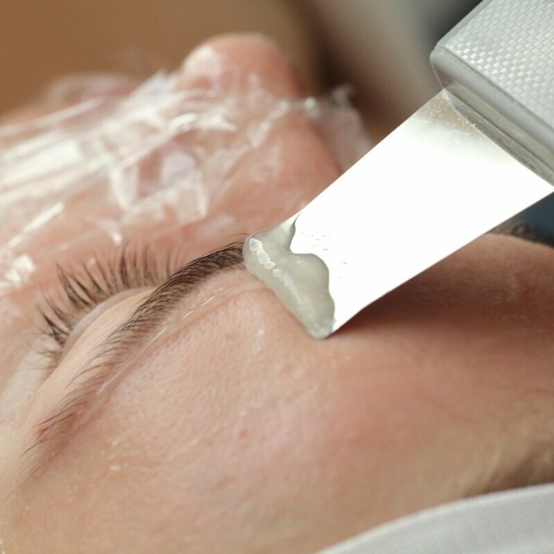 Ультразвуковая чистка лица