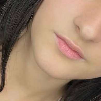 Удаление волос носогубной зоны