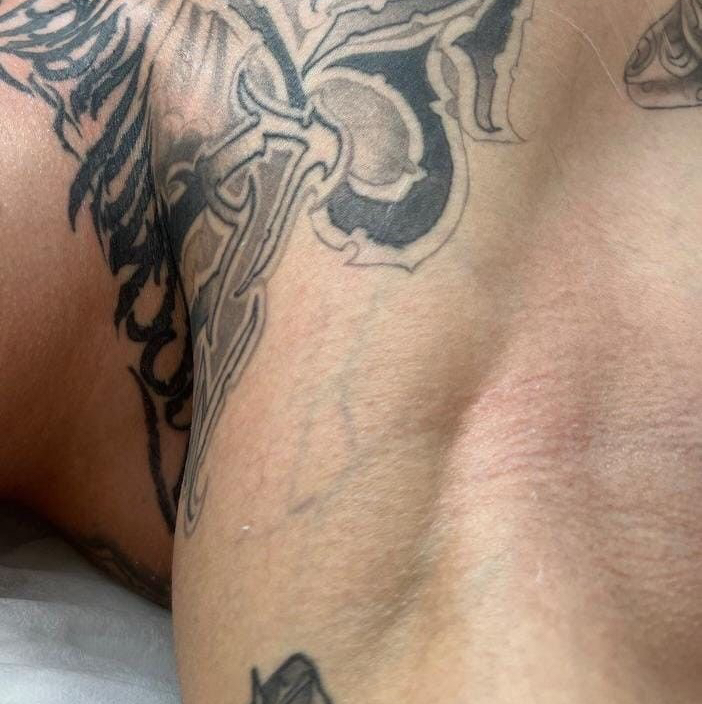 Депиляция подмышки