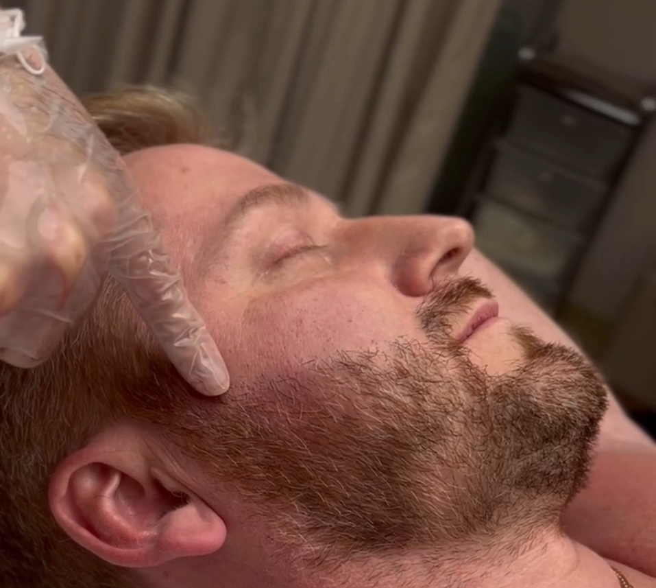 Депиляция лицо, одна зона