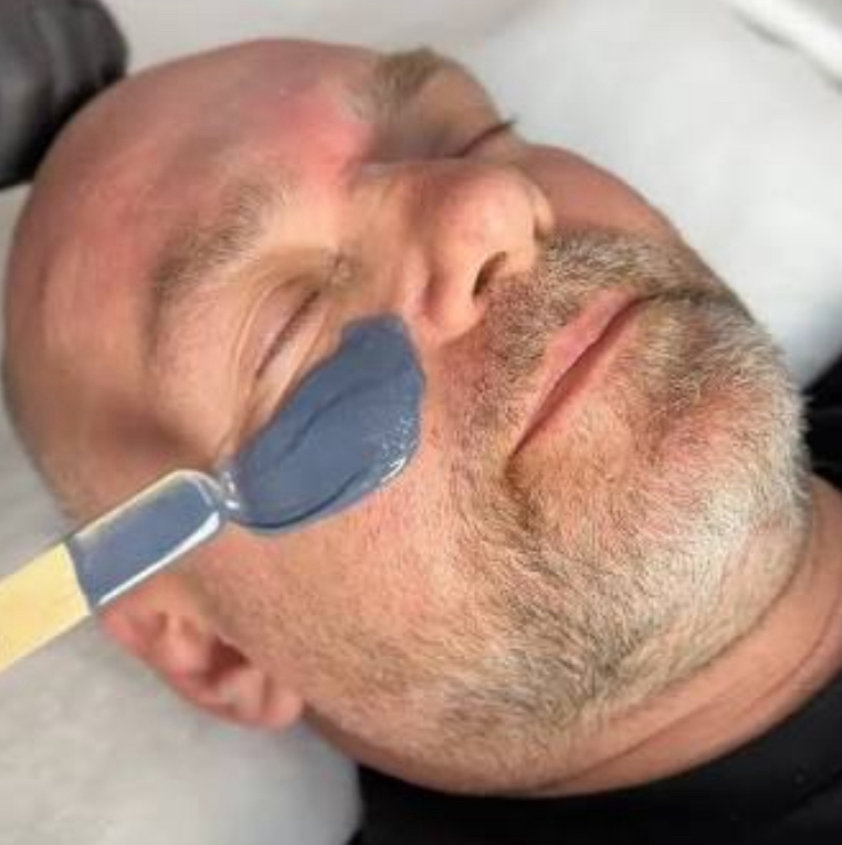 Депиляция лицо целиком