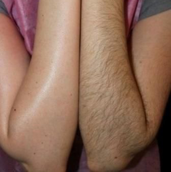 Депиляция руки до локтя