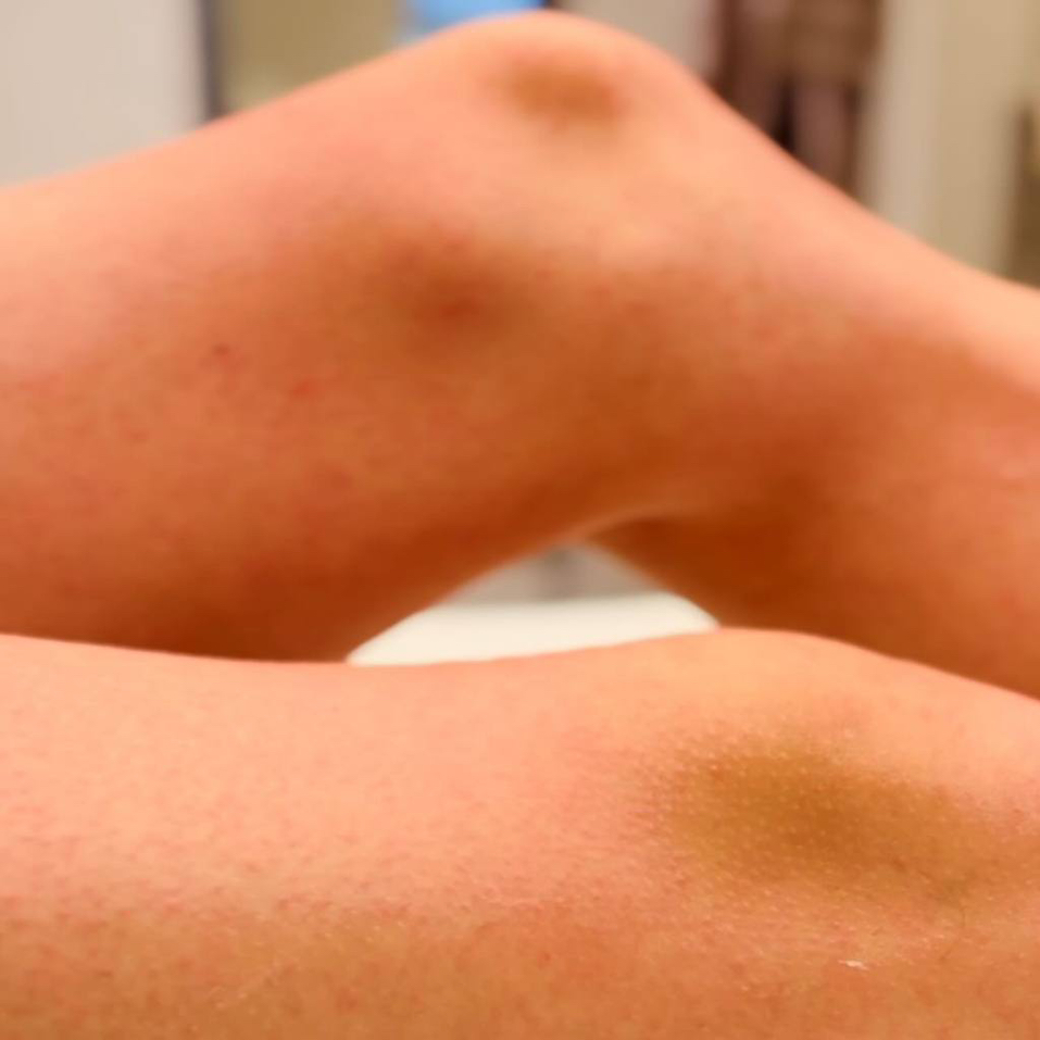 Депиляция ноги целиком