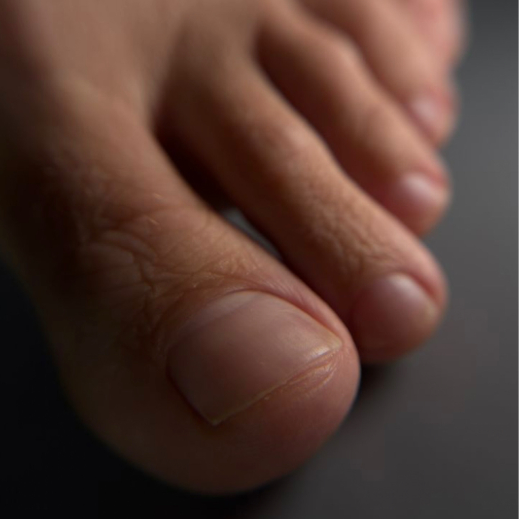 Подологическая комплексная обработка стопы и ногтей(без покрытия)