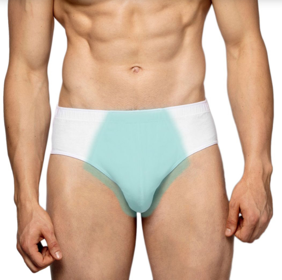 Лазер тотальное бикини