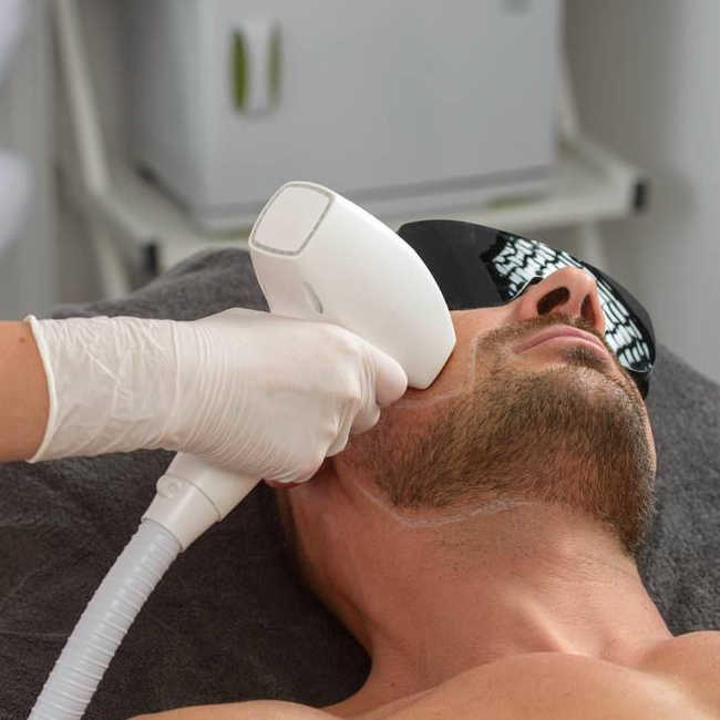 Лазер лицо целиком