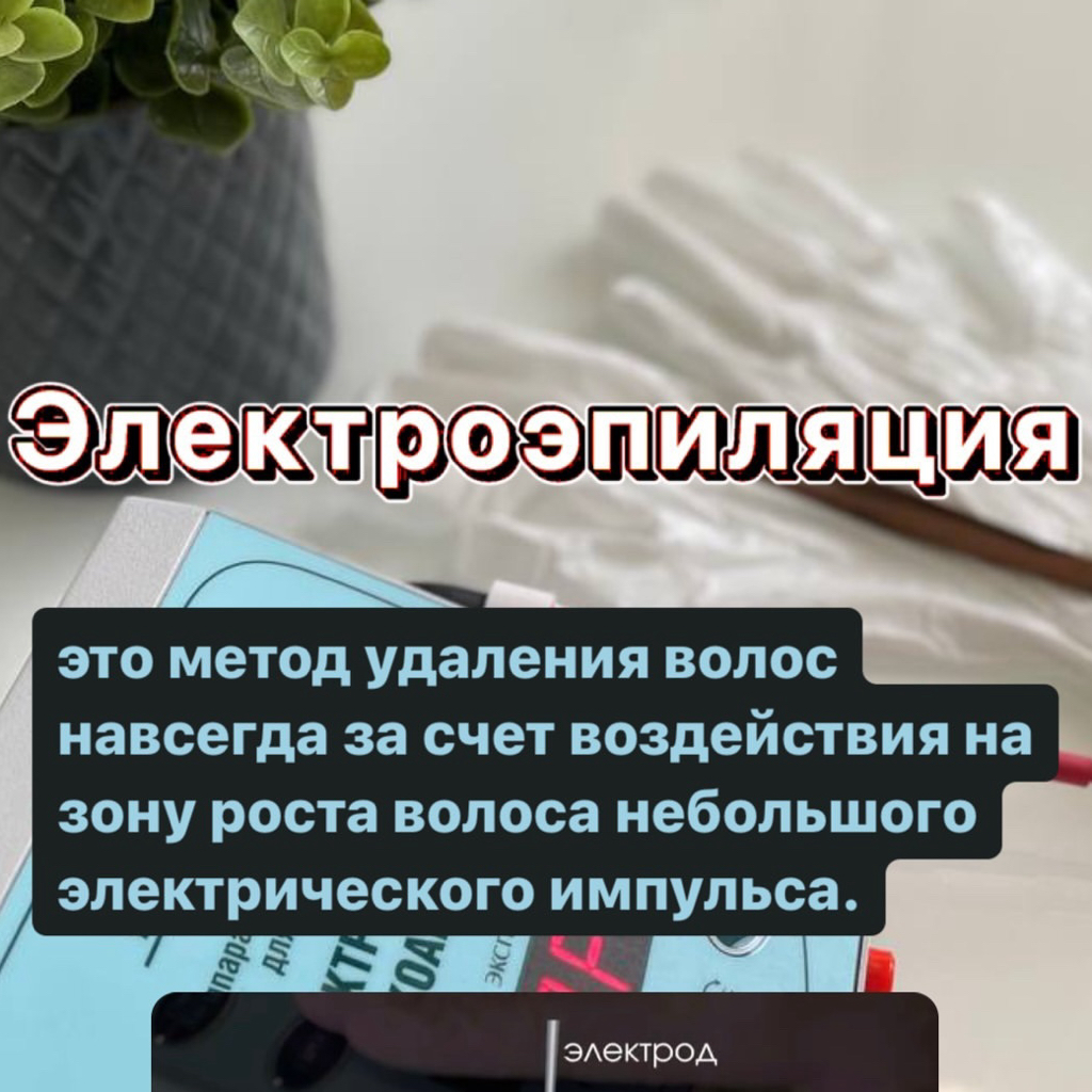 Электроэпиляция