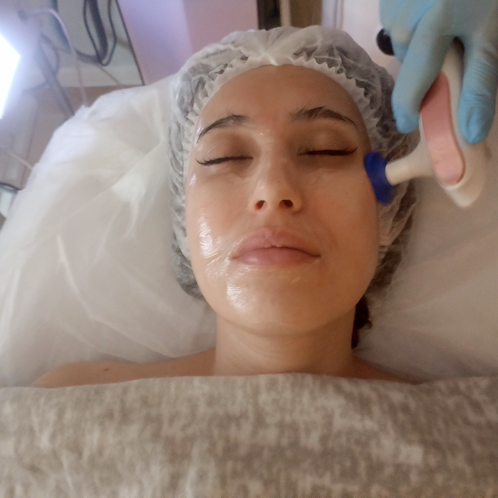 1 из 5 сеансов Индиба на лицо