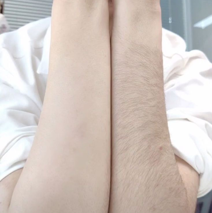 Руки до локтя