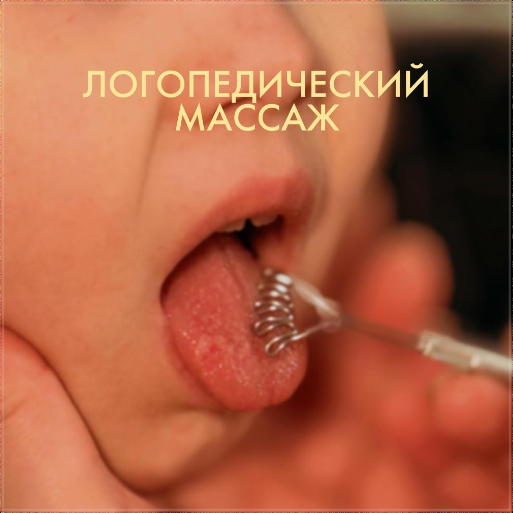 Логопедический массаж