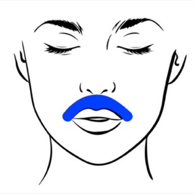 Шугаринг зона над губой