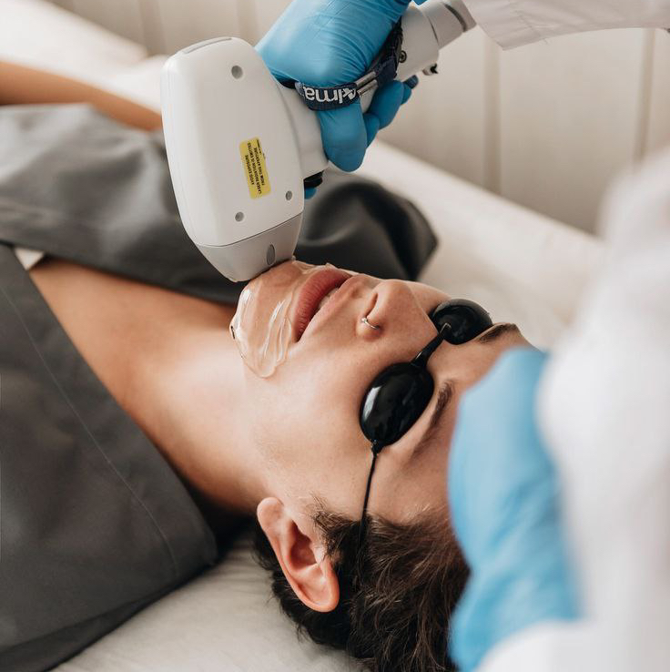 ЛЭ-подбородок, борода