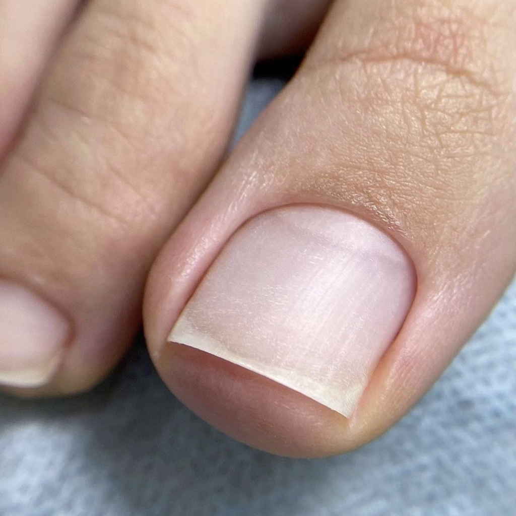 Обработка пальчиков ног