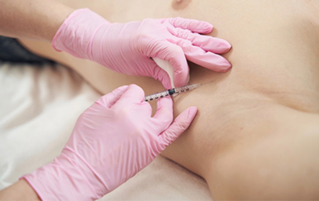 Гипергидроз