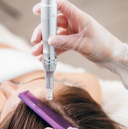 Мезотерапия волос