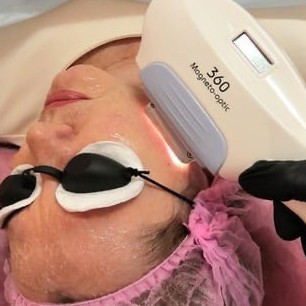 Фотоомоложение