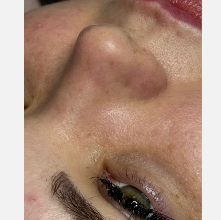 здоровый блеск ( очищение кожи, пилинг, карбокситерапия, завершающий крем)