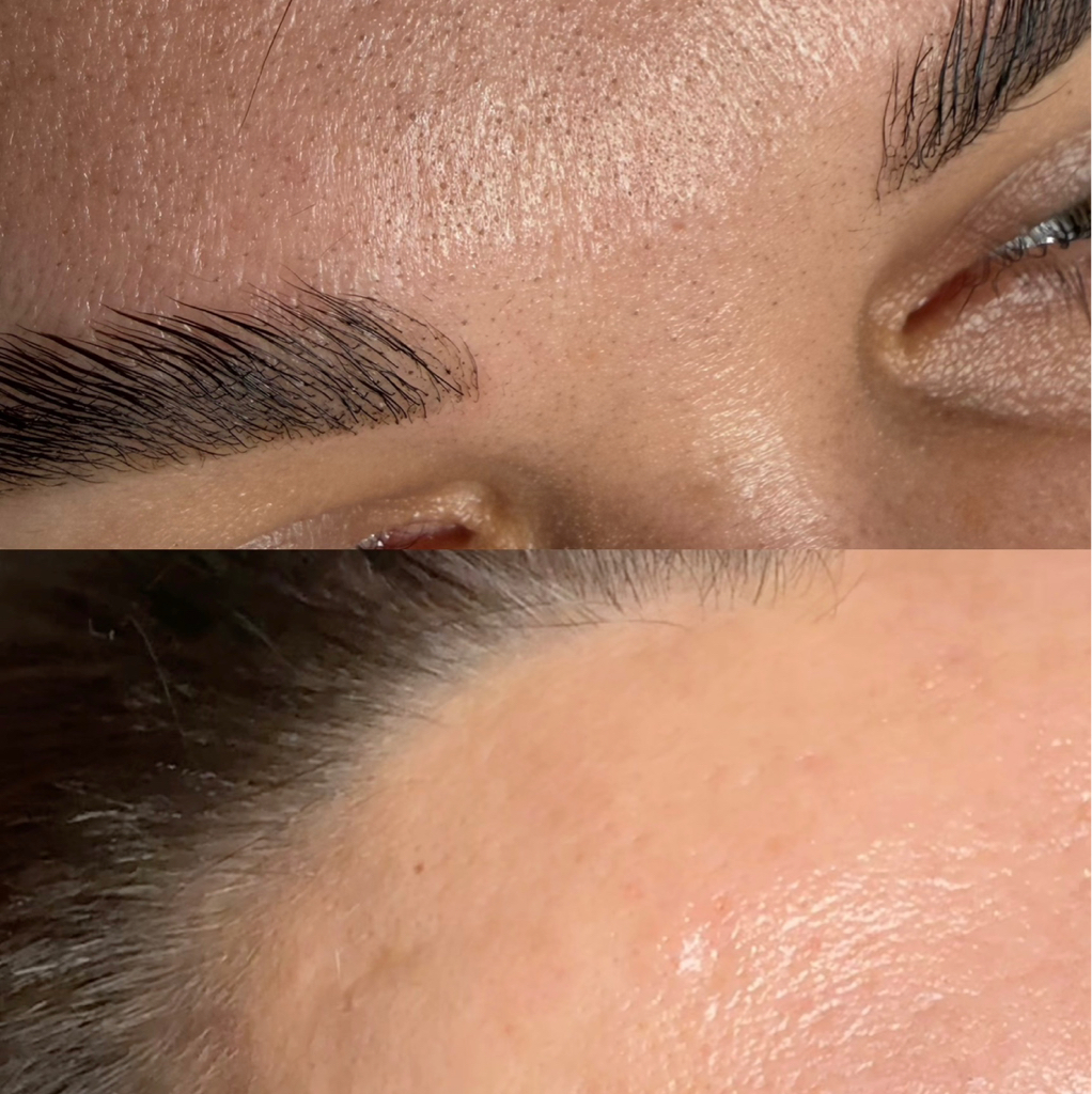 Комбинированная  глубокая чистка лица (протокол по типу кожи)