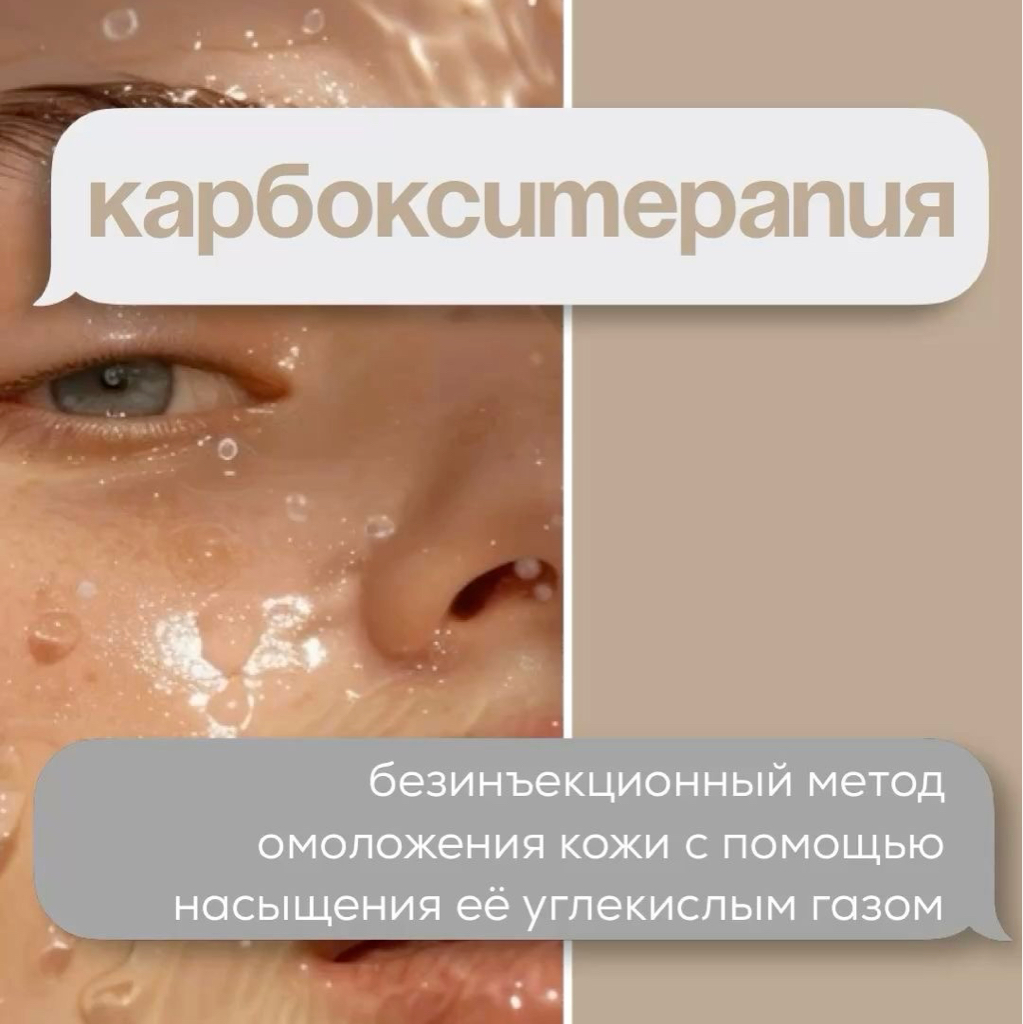 карбокситерапия