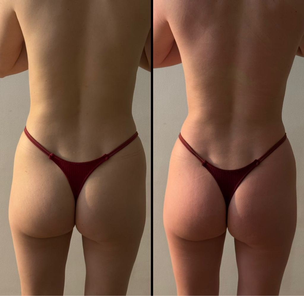 Бандажное обертывание без массажа