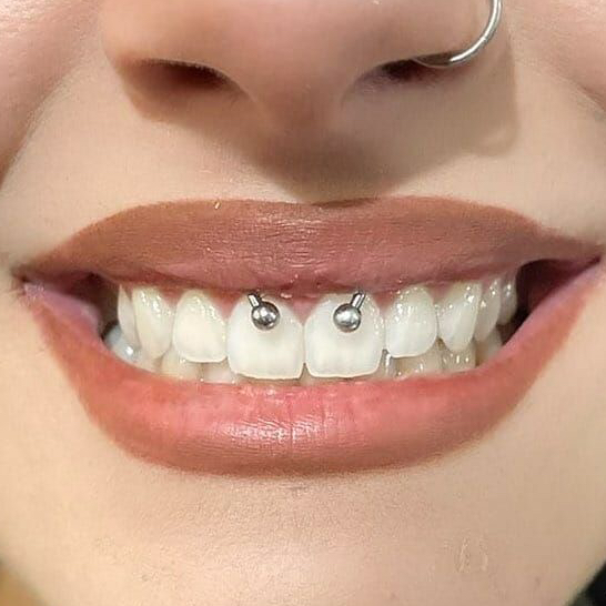 Пирсинг смайл