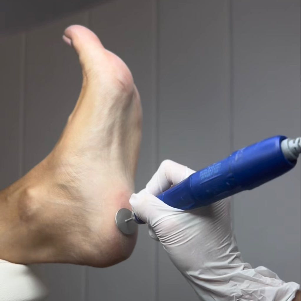 Стопа полностью без покрытия