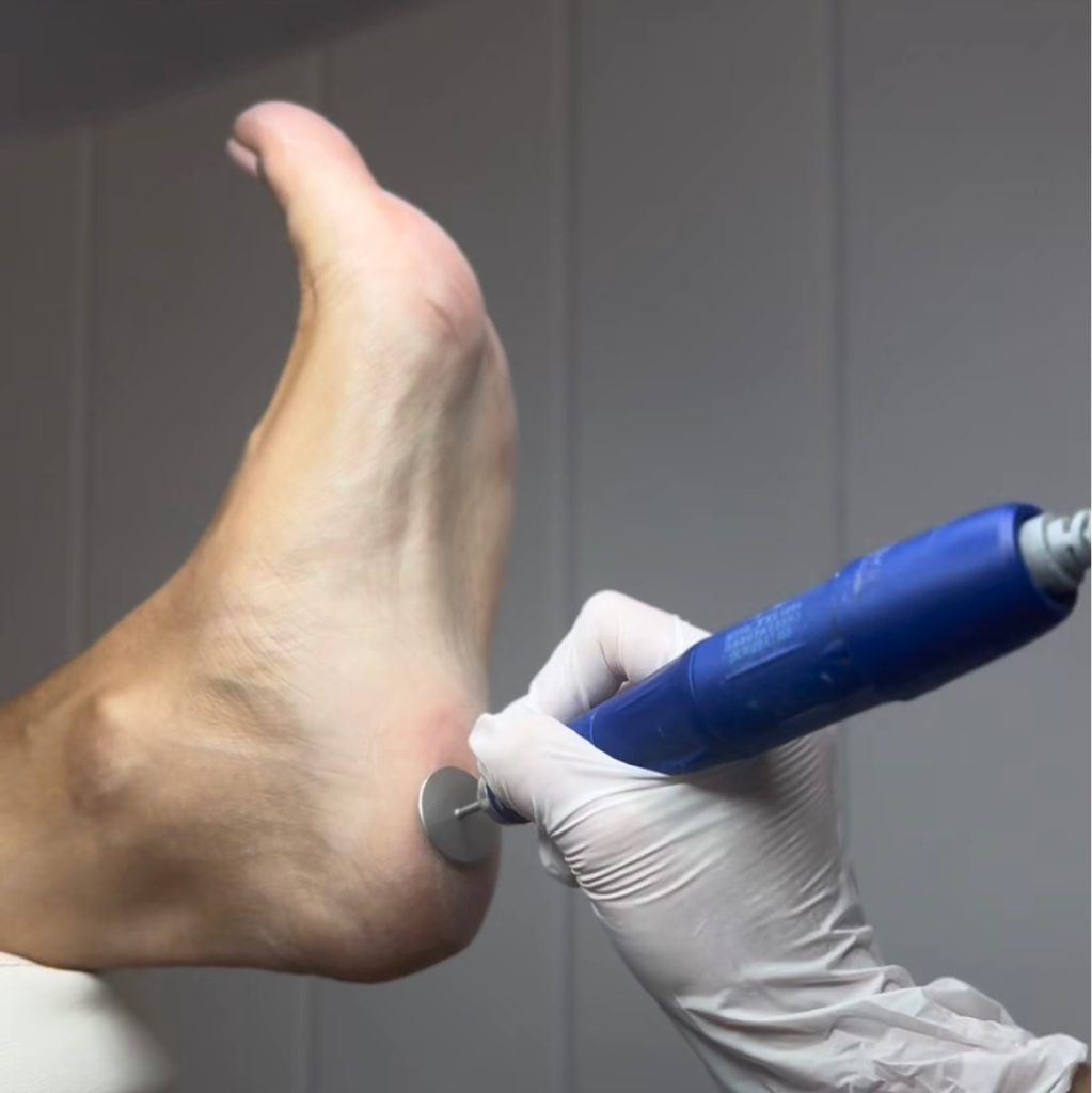 Стопа + пальчики + гель-лак