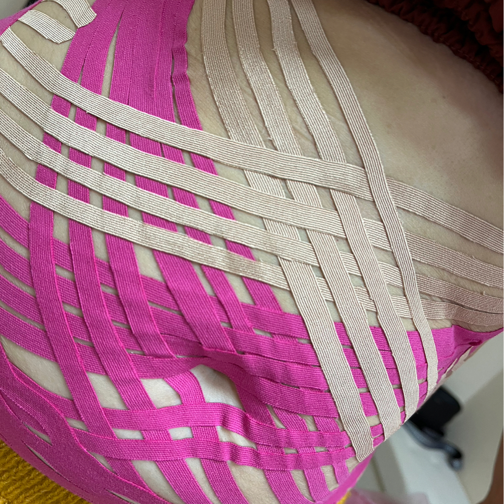 Эстетическое тейпирование живота