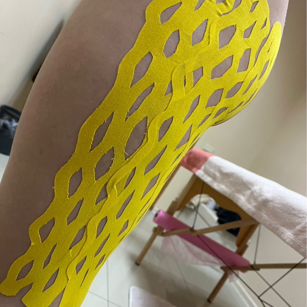 Тейпирование бедра