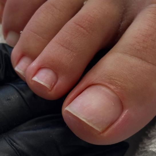 Комплекс «Пальцы без покрытия»