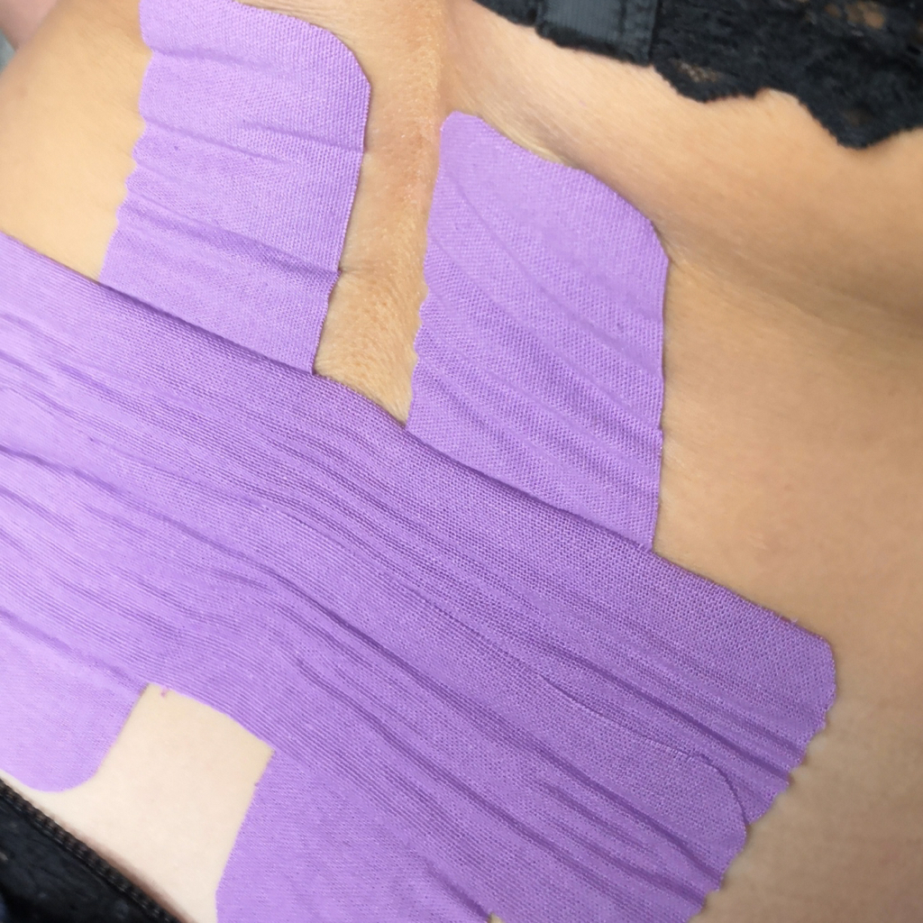 Тейпирование поясницы